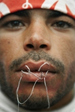 Mabrouk Ghodbani from Kasserine, Tunisia shows his stitched lips. Rached was on hunger strike from 24 January 2016 when he decided on January 27 to sew his lips in protest against the interim government.